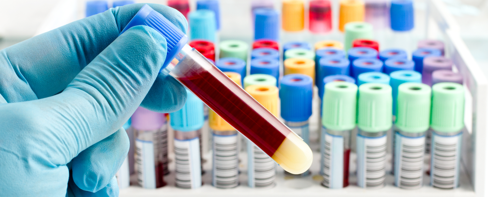 Blood tests