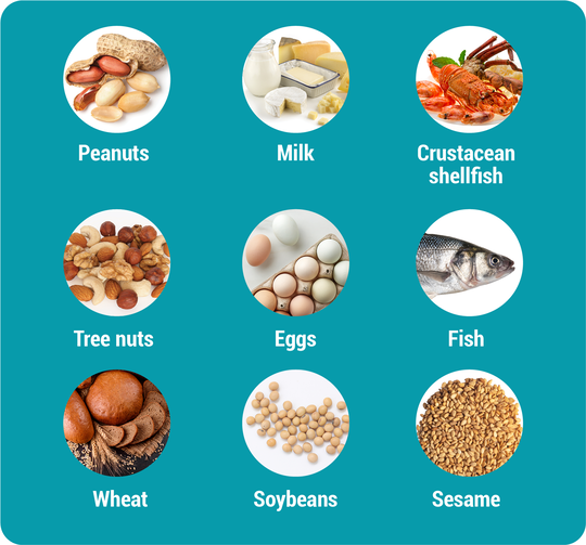 Top 9 Allergens in the US