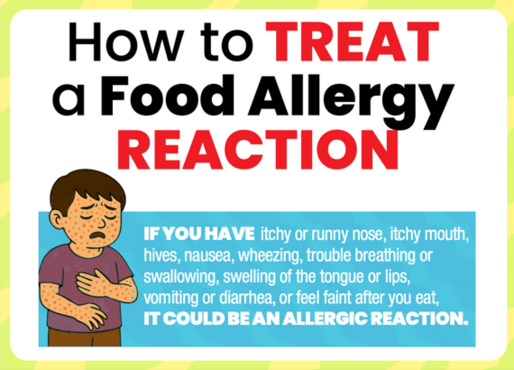 How to Treat a Food Allergy Reaction Preview